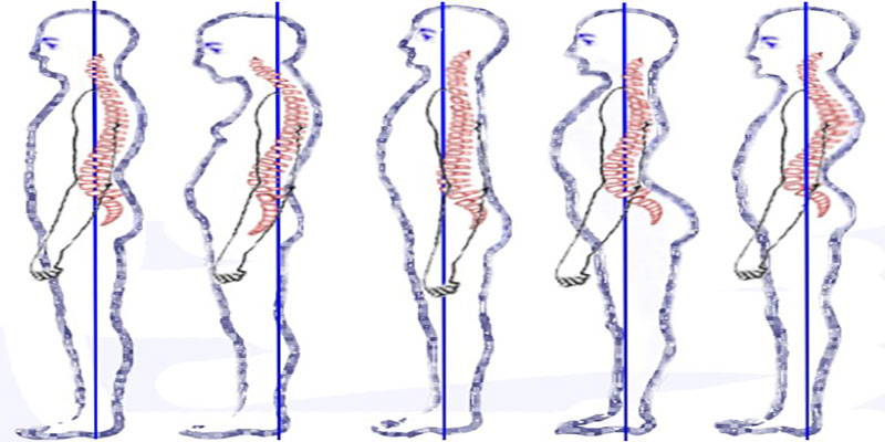 Improve brain function and chronic pain through posture – Natural